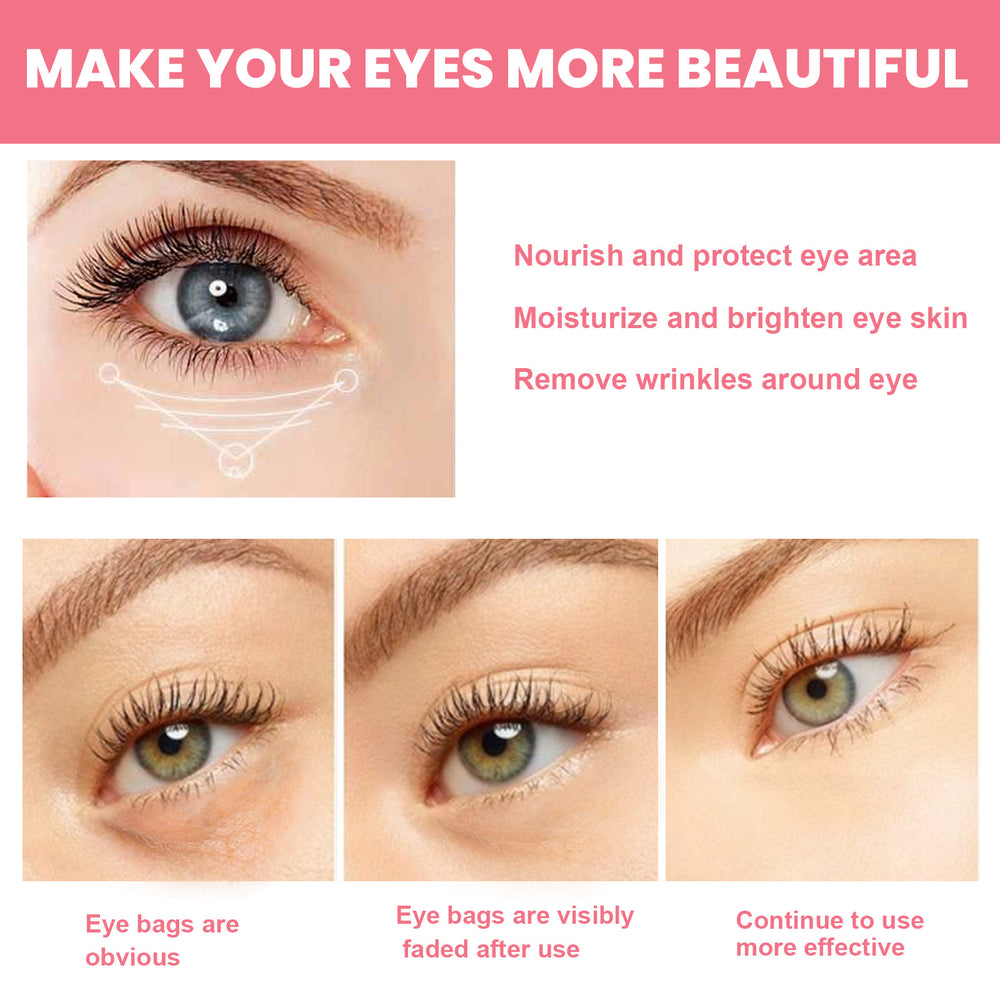 Bálsamo Contorno de Ojos con Rosa Mosqueta — Lifting e Hidratación Profunda - QueensalesOF