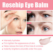 Bálsamo Contorno de Ojos con Rosa Mosqueta — Lifting e Hidratación Profunda - QueensalesOF
