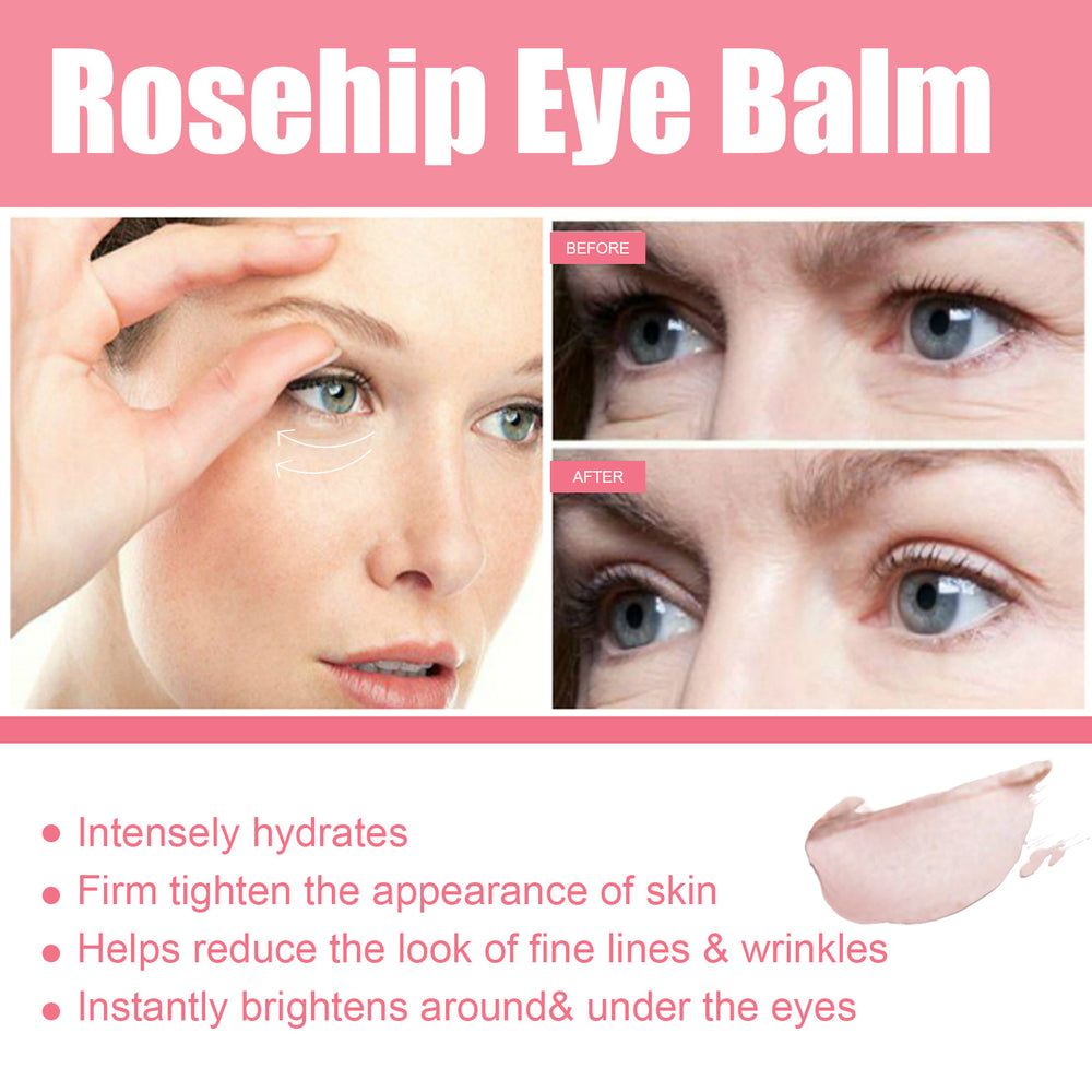 Bálsamo Contorno de Ojos con Rosa Mosqueta — Lifting e Hidratación Profunda - QueensalesOF