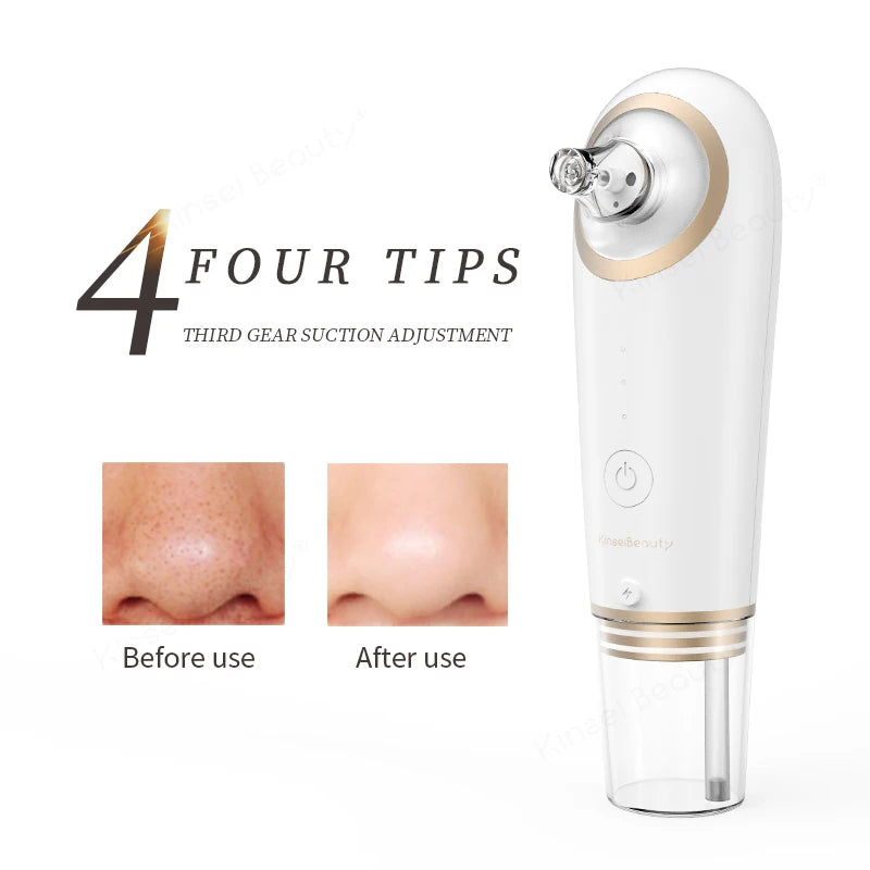 Small Bubble Blackhead Remover – Electric Deep Pore Cleansing Device - QueensalesOF