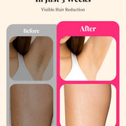 990000 Flashes Hair Removal for Women and Men IPL Hair Removal Body Bikini and Facial Areas Painless Permanent HairRemoval - QueensalesOF