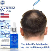 Copper Peptide GHK-cu Hair Growth Serum - Natural Gentle Formula Strengthens Hair Follicles For All Hair Types - QueensalesOF