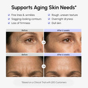 Crema Facial Reafirmante con Retinol — Lifting y Firmeza - QueensalesOF
