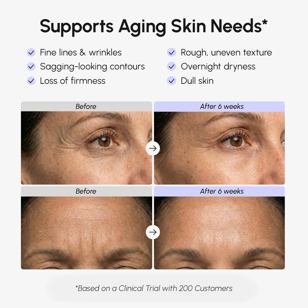 Crema Facial Reafirmante con Retinol — Lifting y Firmeza - QueensalesOF
